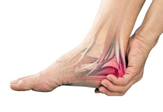 ESPORÃO DE CALCÂNEO