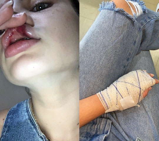 Preso após espancar a ex