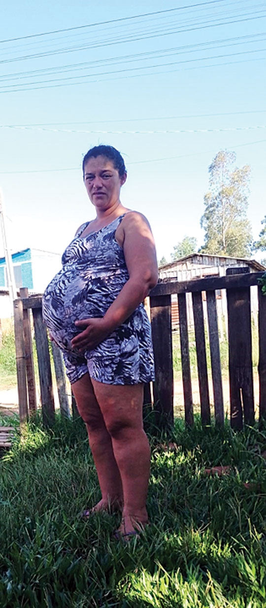 Às vésperas de uma cesariana, viúva perde casa e enxoval em incêndio