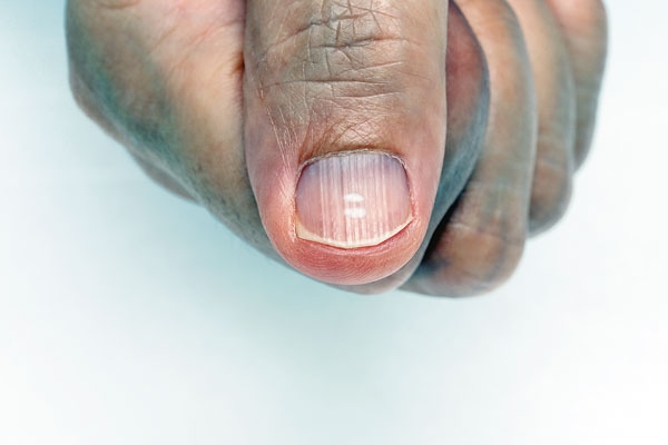 O QUE SUAS  UNHAS  CONTAM