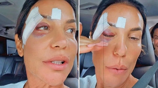 Ivete Sangalo tem alta após desmaio vasovagal