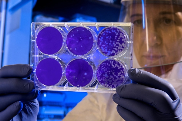 Antibióticos e fatos interessantes que você precisa saber!