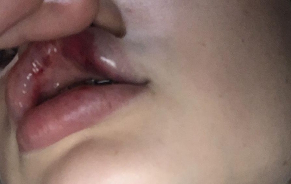 Jovem é espancada e suspeito preso pela Força Tática 