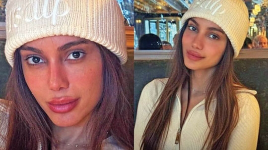 Anitta surpreende com ‘novo rosto’